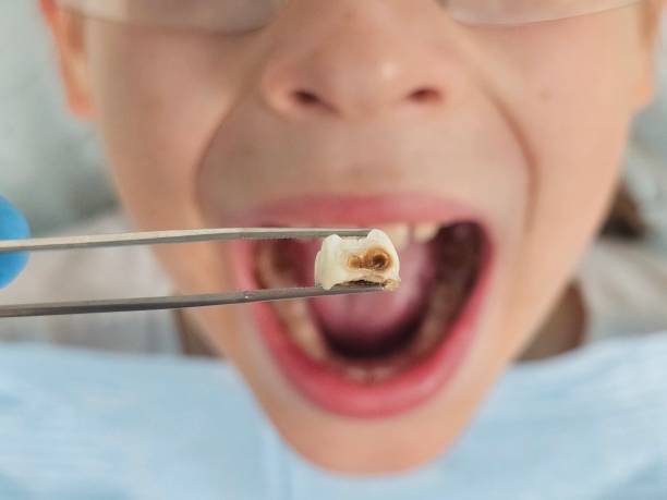 Best Pediatric Emergency Dentist in Longview Heights, WA